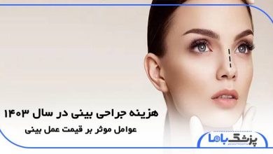 هزینه جراحی بینی در سال 1403
