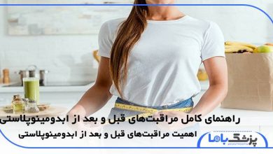 راهنمای کامل مراقبتهای قبل و بعد از ابدومینوپلاستی