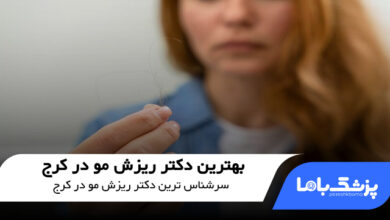 بهترین دکتر ریزش مو در کرج