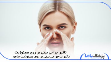 تأثیر جراحی بینی بر روی سینوزیت
