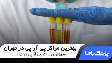 بهترین مراکز پی آر پی در تهران