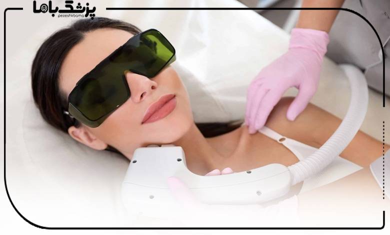 مزایا و معایب لیزر موهای زائد
