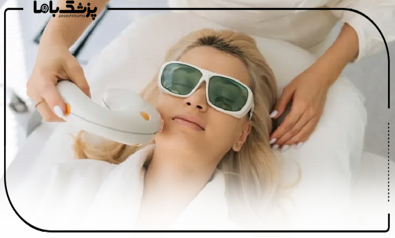 چه کسانی کاندیدای مناسبی برای لیزر نیستند؟
