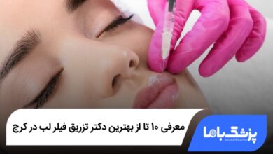 بهترین دکتر تزریق فیلر لب در کرج