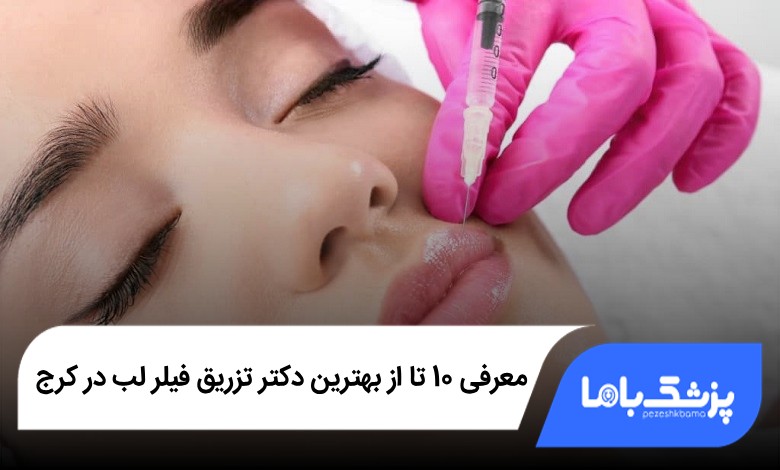 بهترین دکتر تزریق فیلر لب در کرج