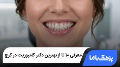 بهترین دکتر کامپوزیت در کرج
