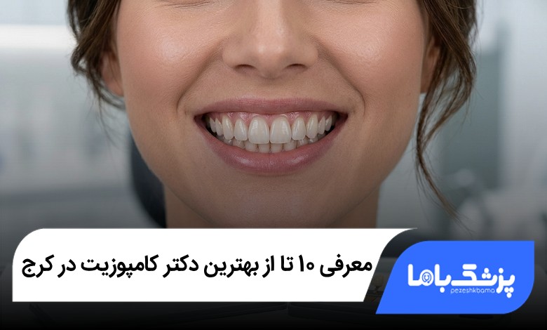 بهترین دکتر کامپوزیت در کرج