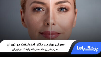 بهترین دکتر اندولیفت در تهران