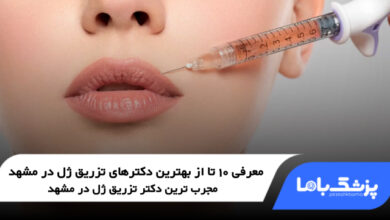 بهترین دکتر تزریق ژل در مشهد