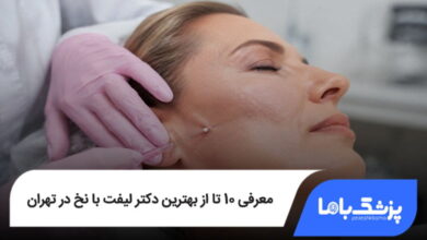 بهترین دکتر لیفت با نخ در تهران