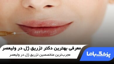 بهترین دکتر تزریق ژل در ولیعصر