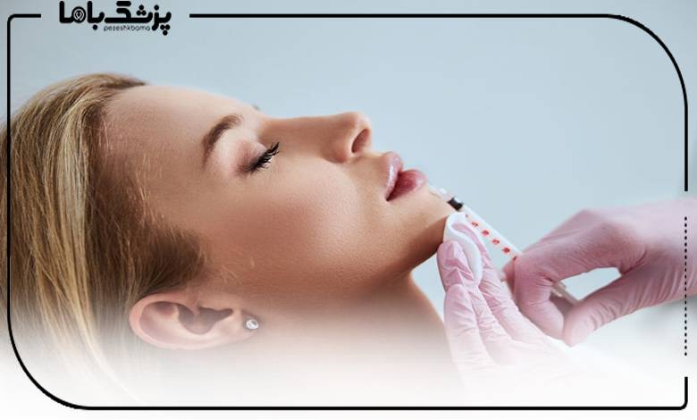 خدمات تخصصی دکتر تزریق ژل لب شهرک غرب