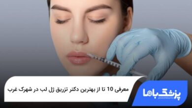 بهترین دکتر تزریق ژل لب در شهرک غرب