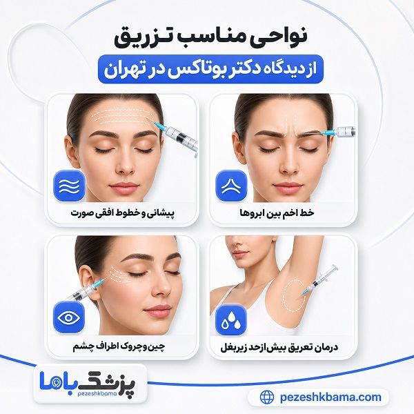نواحی مناسب تزریق از دیدگاه دکتر بوتاکس در تهران