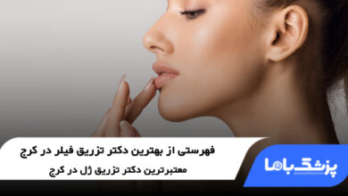 بهترین دکتر تزریق فیلر در کرج
