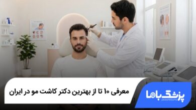 بهترین دکتر کاشت مو در ایران