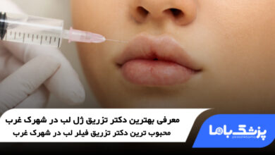 بهترین دکتر تزریق ژل لب در شهرک غرب