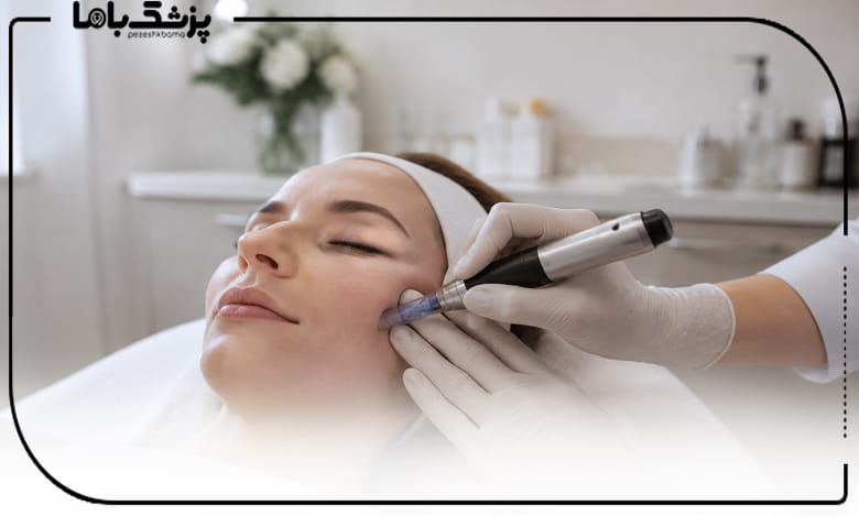 چگونه یک مرکز میکرونیدلینگ مناسب انتخاب کنیم؟