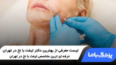 بهترین دکتر لیفت با نخ در تهران
