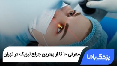 بهترین جراح لیزیک در تهران