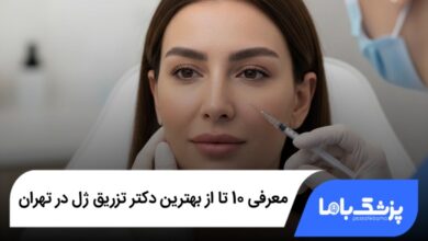 نقاط رایج تزریق ژل در صورت در تهران