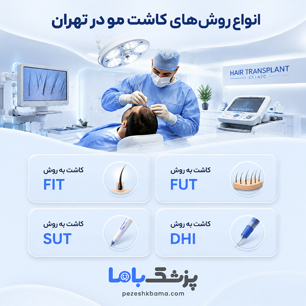 انواع روشهای کاشت مو در تهران