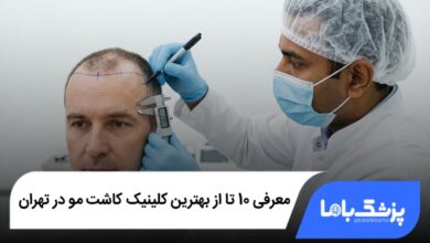 بهترین کلینیک کاشت مو در تهران