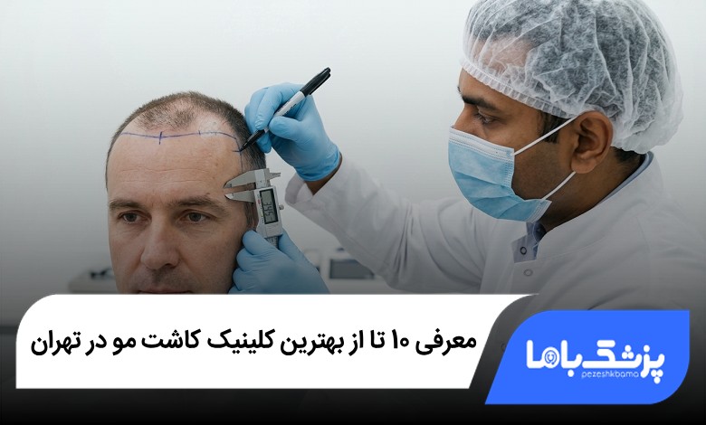 بهترین کلینیک کاشت مو در تهران