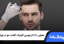 بهترین کلینیک کاشت مو در تهران