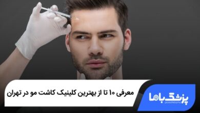 بهترین کلینیک کاشت مو در تهران