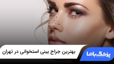 بهترین جراح بینی استخوانی در تهران