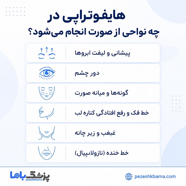 هایفوتراپی در چه نواحی از صورت انجام میشود؟