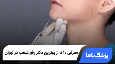 بهترین دکتر رفع غبغب در تهران
