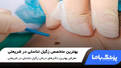 بهترین متخصص زگیل تناسلی در شریعتی