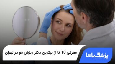 بهترین دکتر ریزش مو در تهران