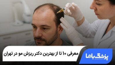 بهترین دکتر ریزش مو در تهران