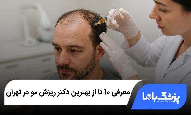 بهترین دکتر ریزش مو در تهران