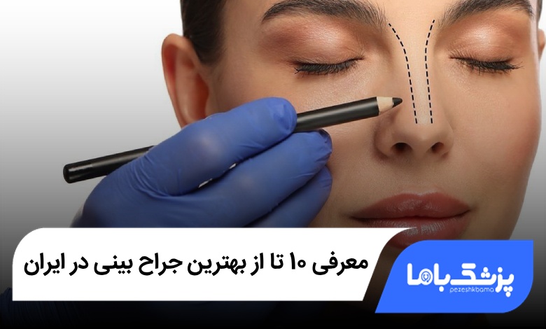 بهترین جراح بینی در ایران