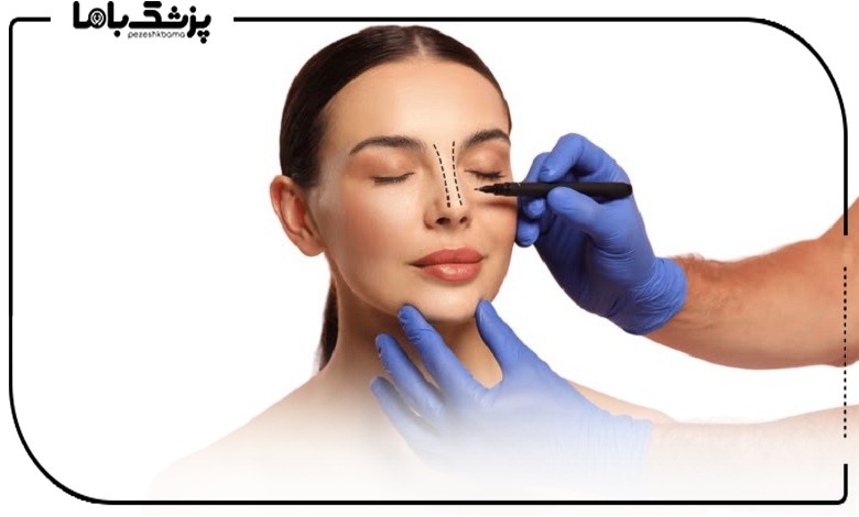 معاینه توسط بهترین جراح بینی گوشتی در اصفهان