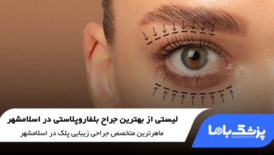 بهترین جراح بلفاروپلاستی در اسلامشهر