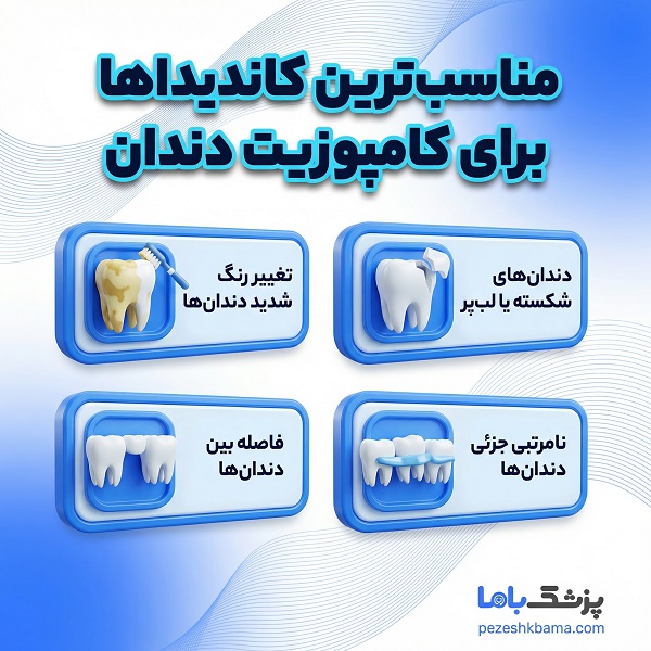 مناسب ترین کاندیداها برای کامپوزیت دندان