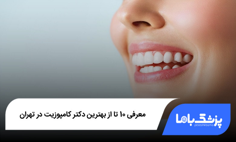 بهترین دکتر کامپوزیت در تهران