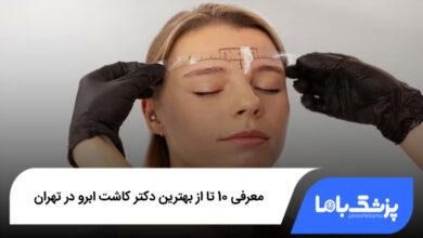 بهترین دکتر کاشت ابرو در ایران