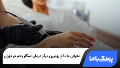 بهترین مرکز درمان اسکار زخم در تهران