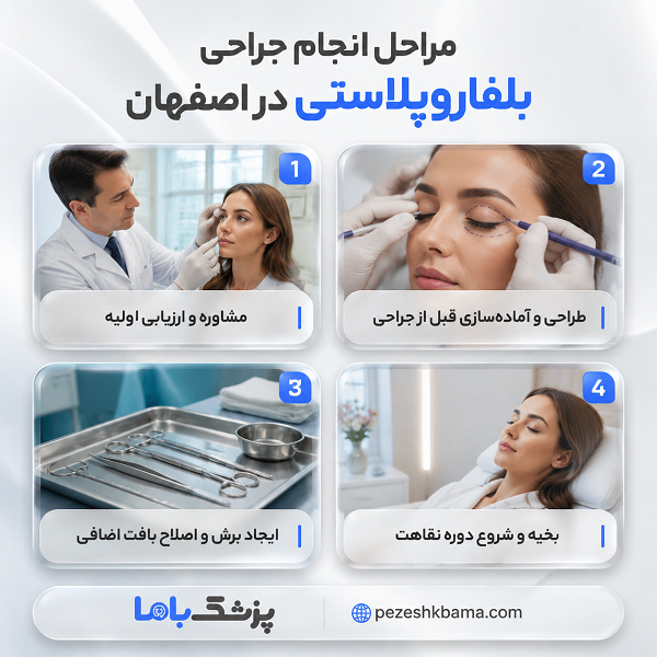 مراحل انجام جراحی بلفاروپلاستی در اصفهان