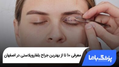 بهترین جراح بلفاروپلاستی در اصفهان