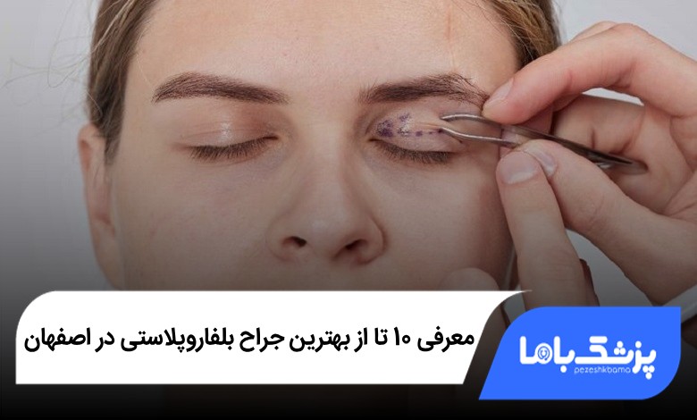 بهترین جراح بلفاروپلاستی در اصفهان