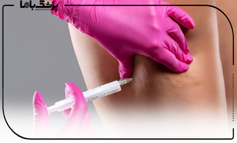 ماندگاری فیلر بادی چقدر است و چگونه آن را افزایش دهیم؟