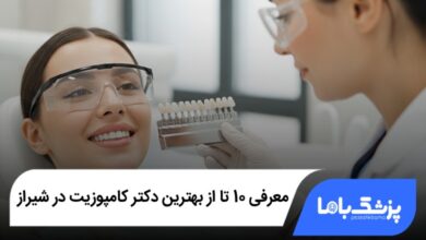 بهترین دکتر کامپوزیت در شیراز