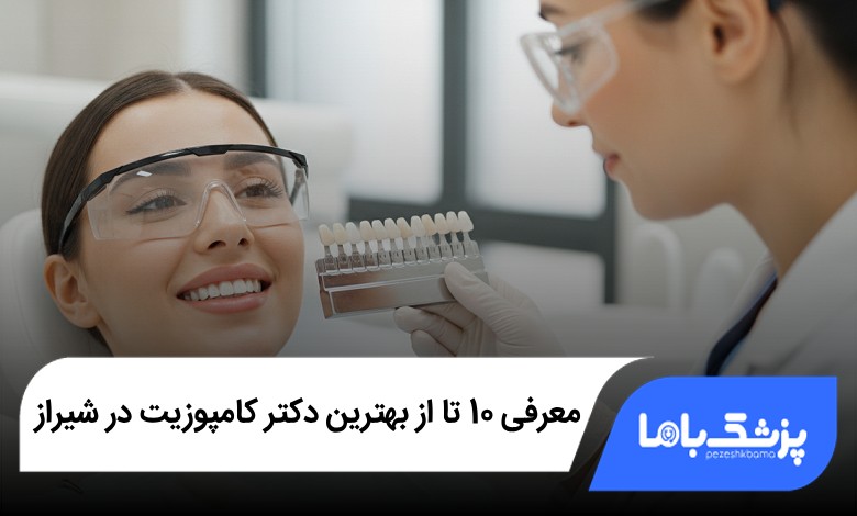 بهترین دکتر کامپوزیت در شیراز